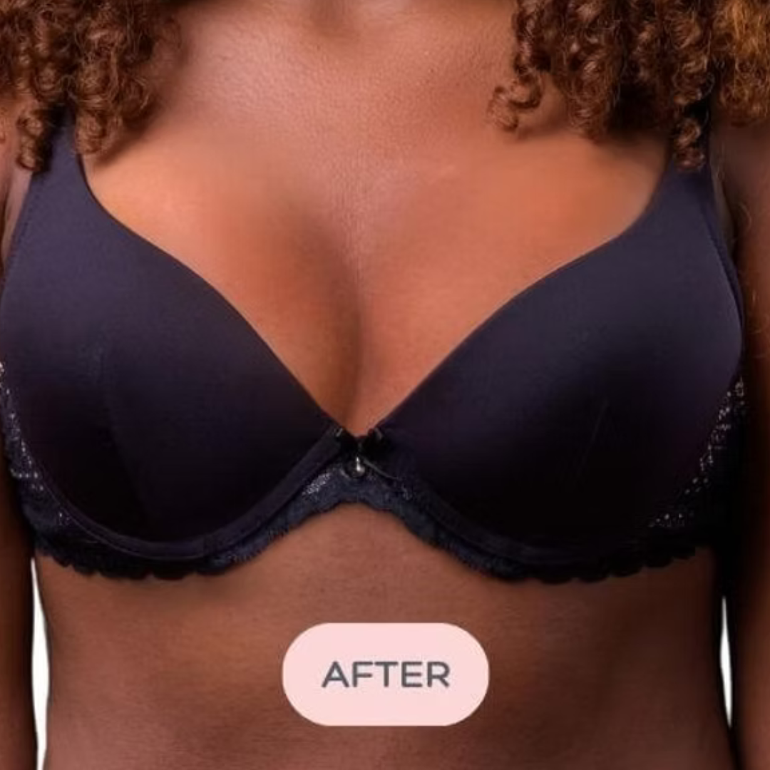 image showing bra after using the evenly bra balancer