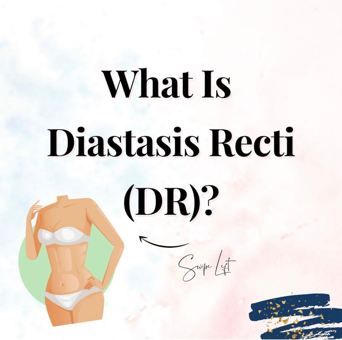 what is diastasis recti 